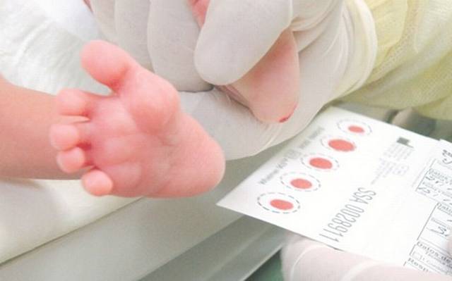 Afecta hipotiroidismo a uno de cada 2 mil 800 nacimientos: IMSS