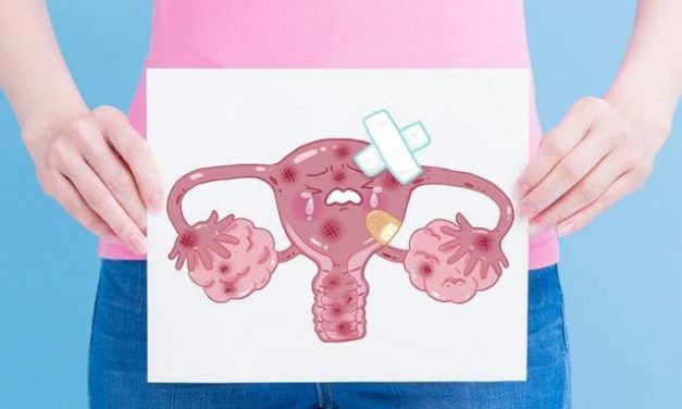 Registró SLP 98 muertes por Cáncer Cervicouterino el año anterior: SS
