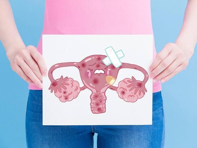Registró SLP 98 muertes por Cáncer Cervicouterino el año anterior: SS