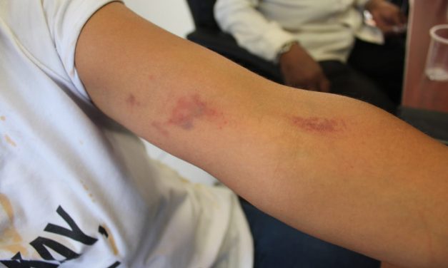 Condena Derechos Humanos actuación de policías municipales en desalojo de comerciantes.
