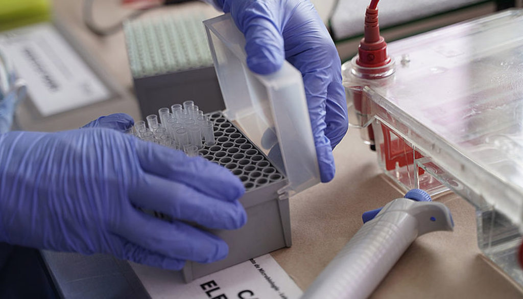 Durante pandemia, Gobierno del Estado adquirió más de 800 mil equipos de protección biológica para personal de salud.