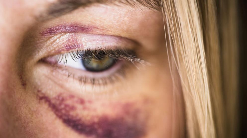 Atiende CJM 6 mil 720 mujeres en situación de violencia durante 2020