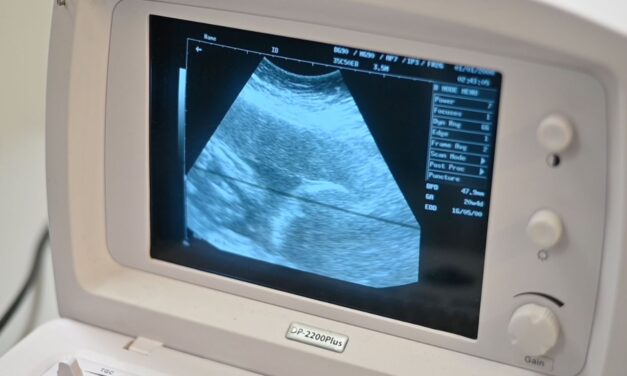 Atención de control prenatal de calidad en la UCIIS de la UASLP