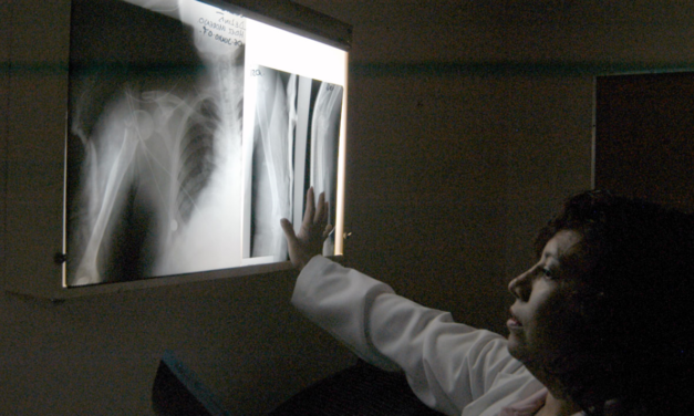 Llama IMSS San Luis Potosí a prevenir daños por tabaquismo